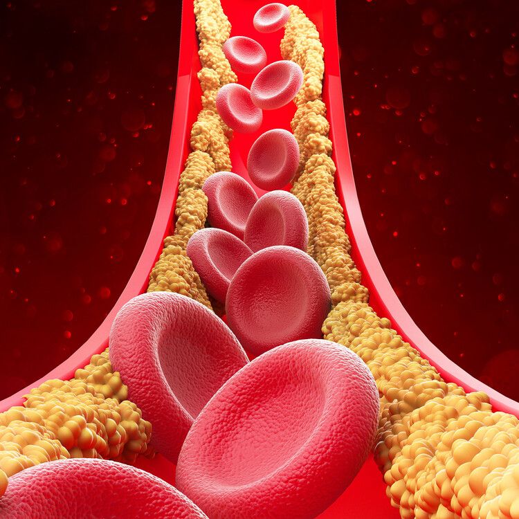 Cholesterol